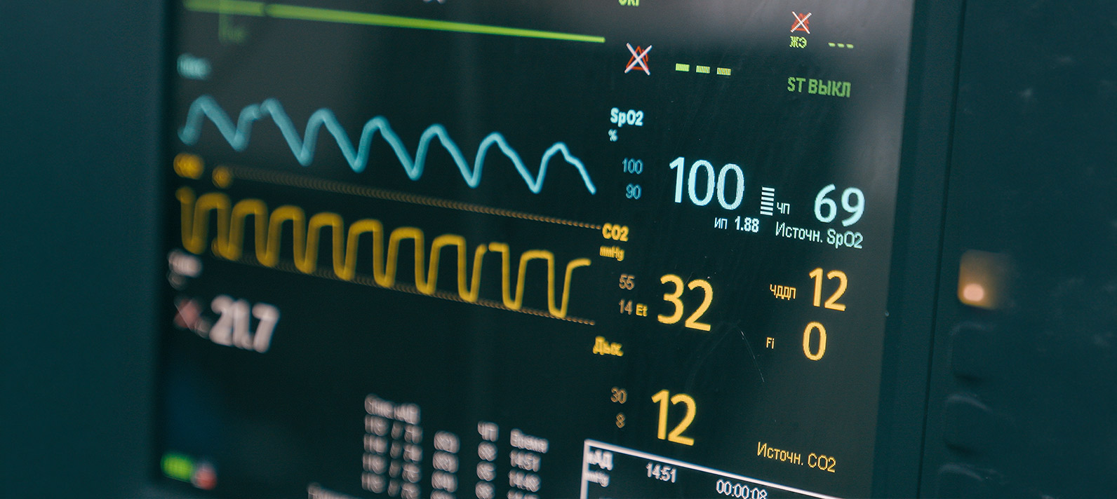 ICU-Monitor